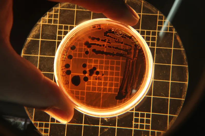 Mold, Mess, and a Miracle: The Accidental Discovery That Changed Medicine Forever